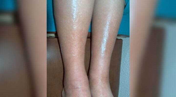 DR. RUBÉN MONTOYA VELÁZQUEZ