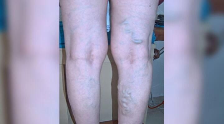 DR. RUBÉN MONTOYA VELÁZQUEZ