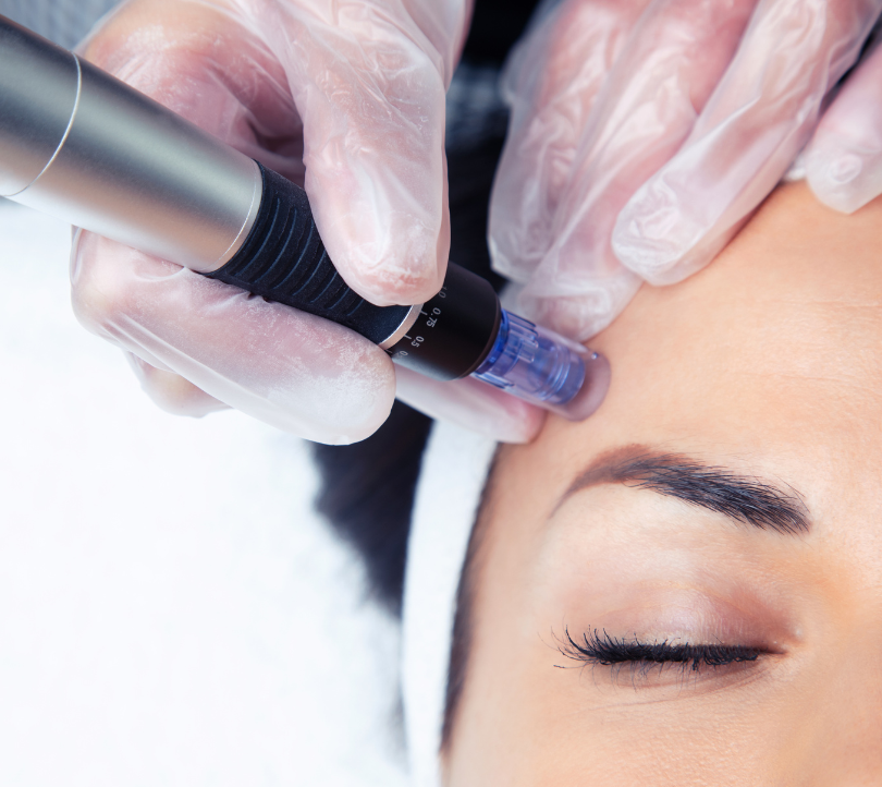 Eine Nahaufnahme des Gesichts einer Frau mit der Hand am Kinn.