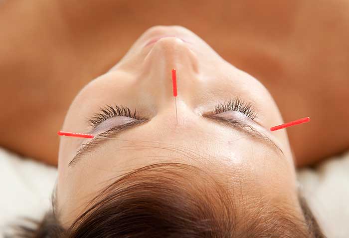 Facial rejuvenation acupuncture Vancouver downtown