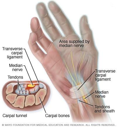 Athens, GA Carpal Tunnel Syndrome - Reddy Medical Group