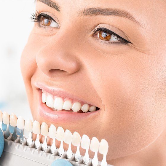 Teeth Whitening — Margate, FL — Crescent Dental