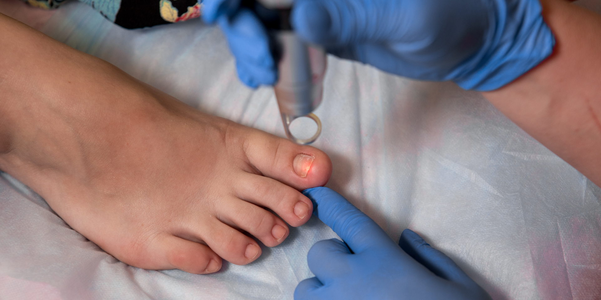 Foot care services - A foot care specialist performing a medical procedure on a client's toenail for better health.