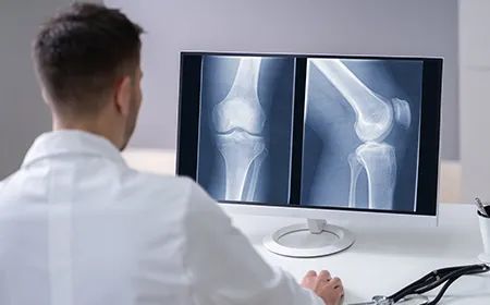a doctor is looking at an x-ray of a knee on a computer screen .