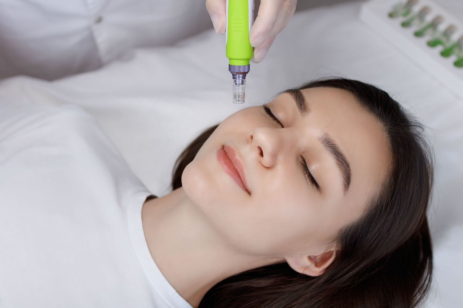 woman having a microneedling treatment