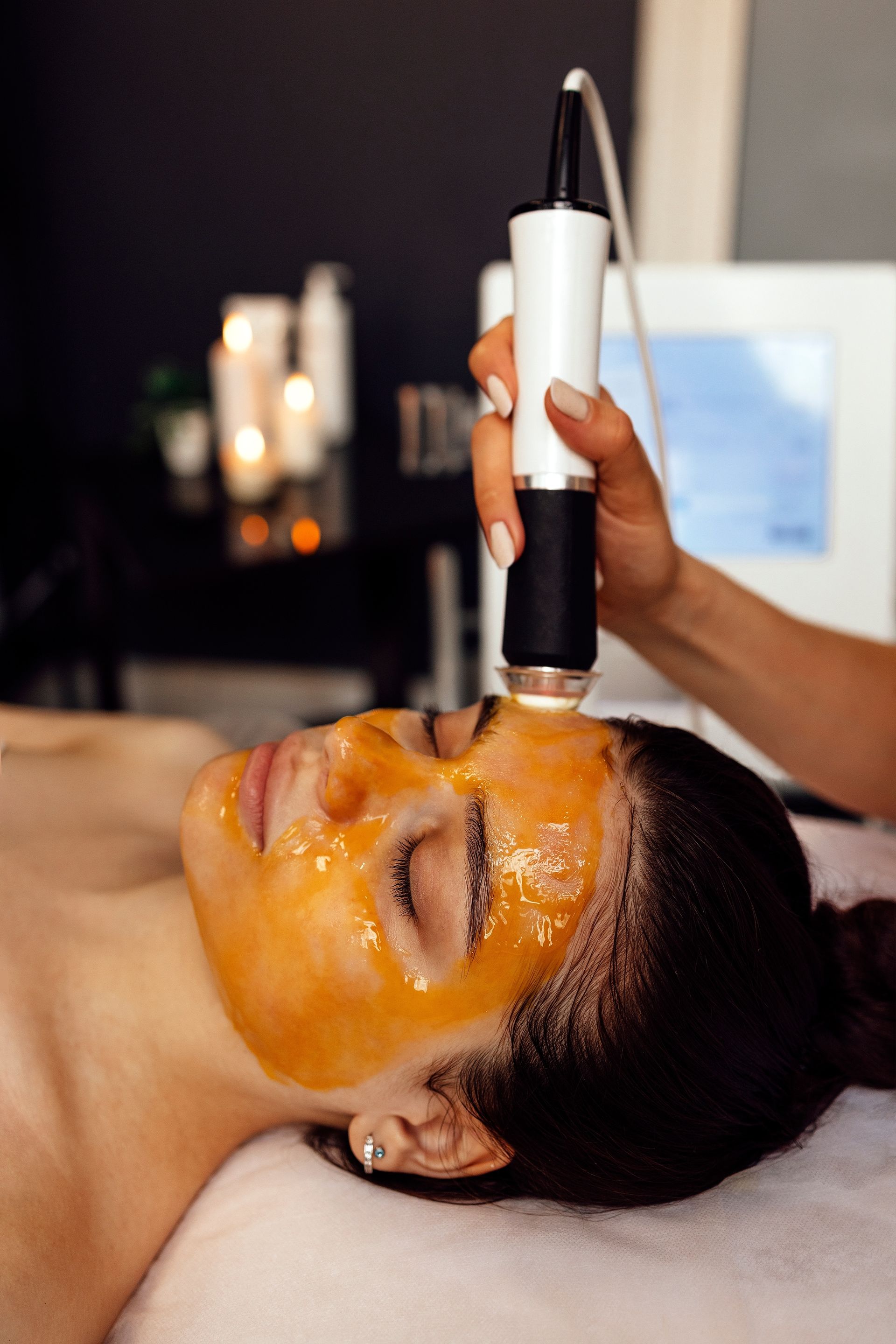 applying chemical peel