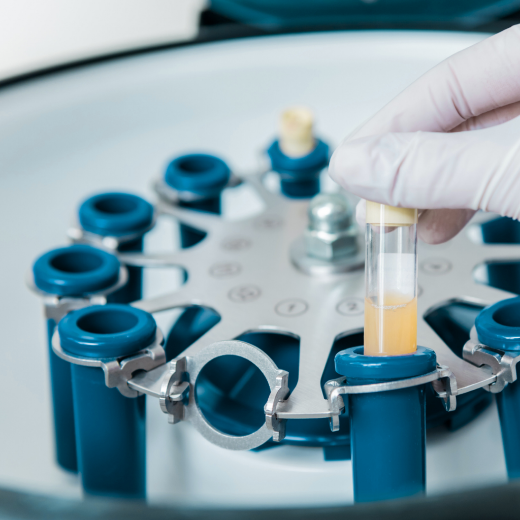 A hand is holding a test tube in front of a centrifuge