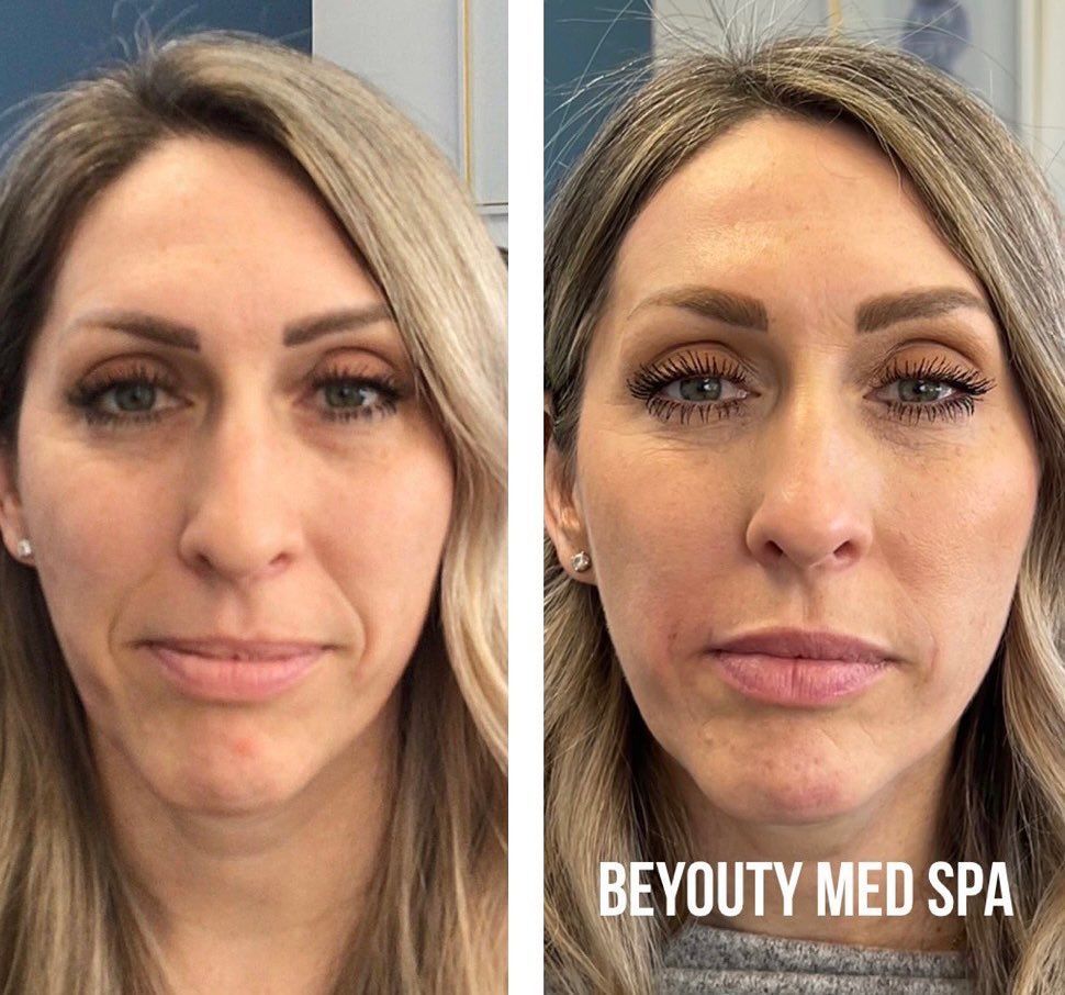 A before and after photo of a woman 's face.