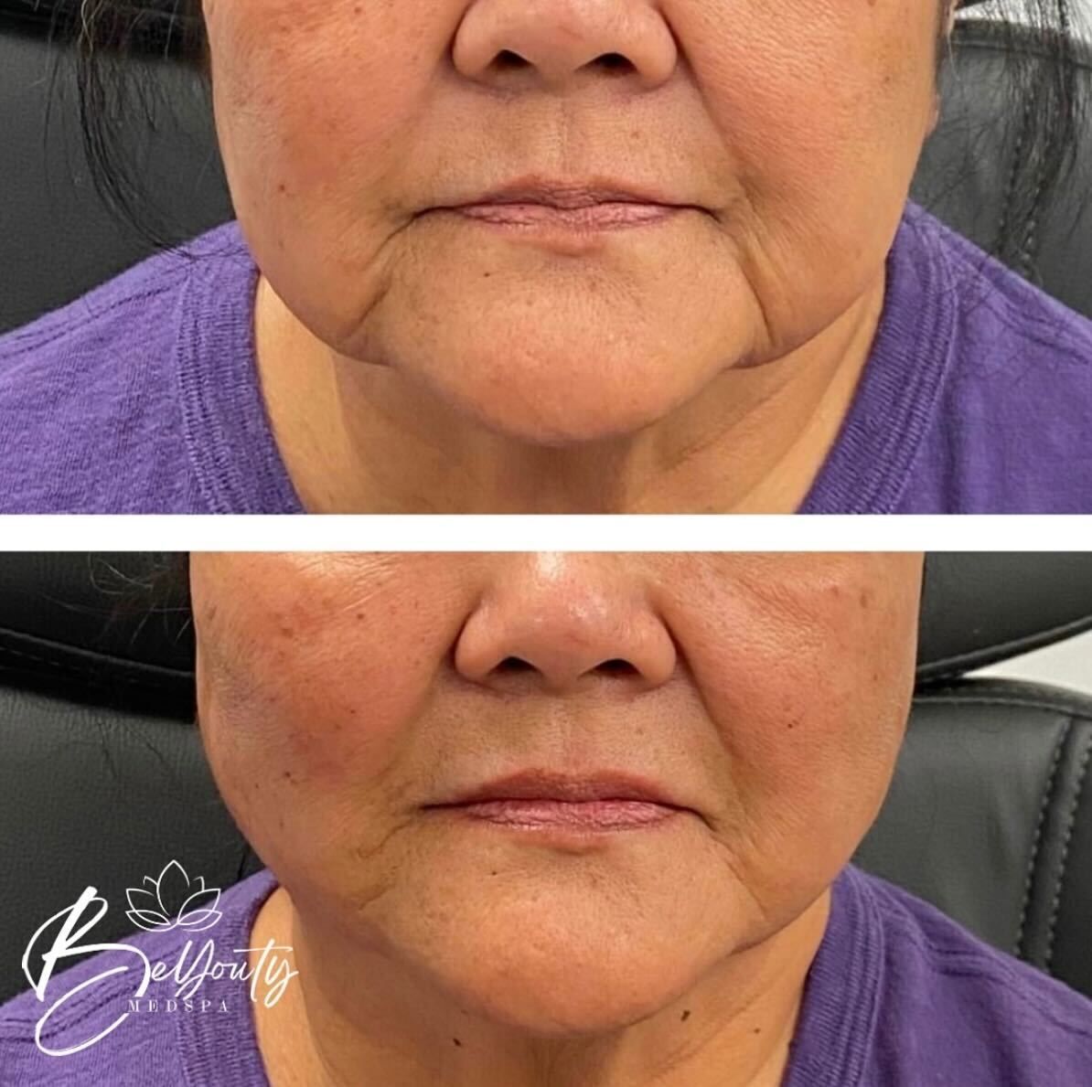 A before and after photo of a woman 's face