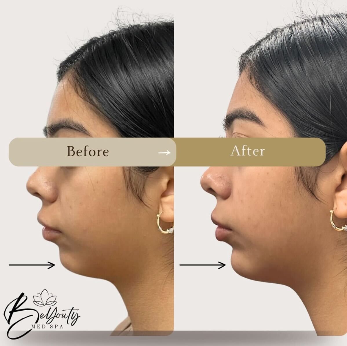 A before and after photo of a woman 's face