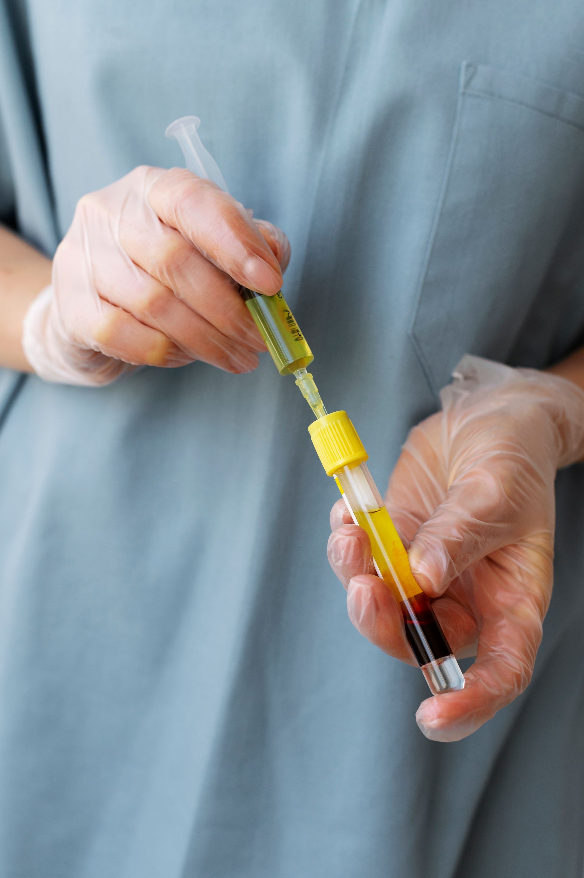 a nurse is holding a syringe and a test tube with a yellow cap