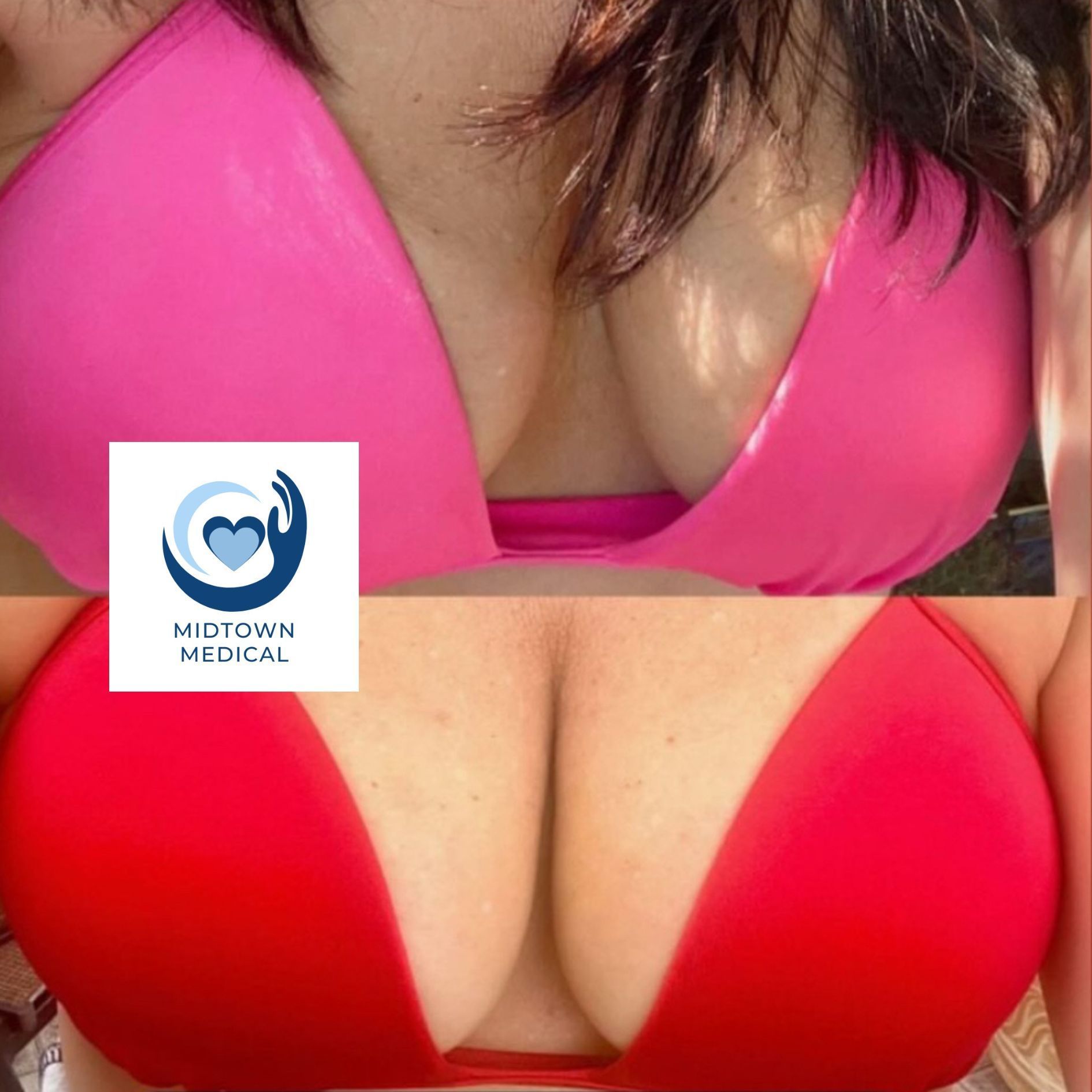 Two bikini tops, one pink, one red, showing breast augmentation results. Midtown Medical logo present.