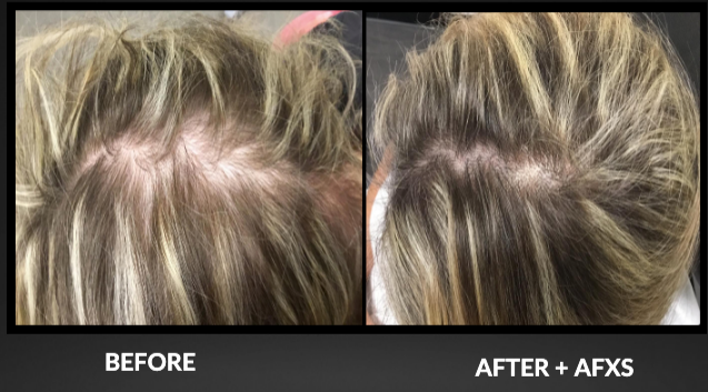 Before-and-after comparison of blonde hair. Left: sparse hair. Right: fuller, thicker hair after using AFXS product.