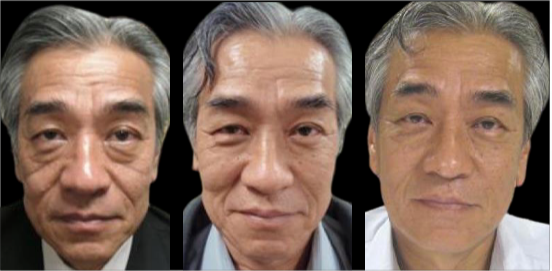 Three side-by-side portraits of an older Asian man, showing a before-and-after skin treatment, with fewer wrinkles in the last photo.