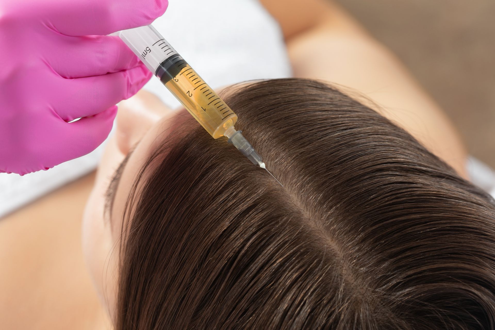 A woman is getting a hair treatment with a syringe.