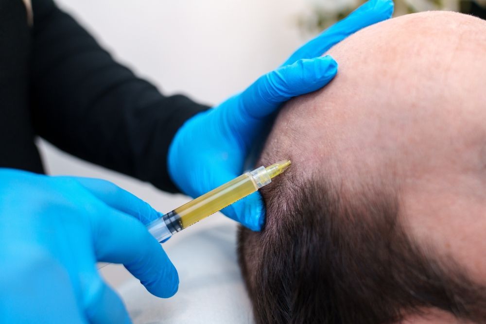 A man is getting an injection in his head with a syringe.