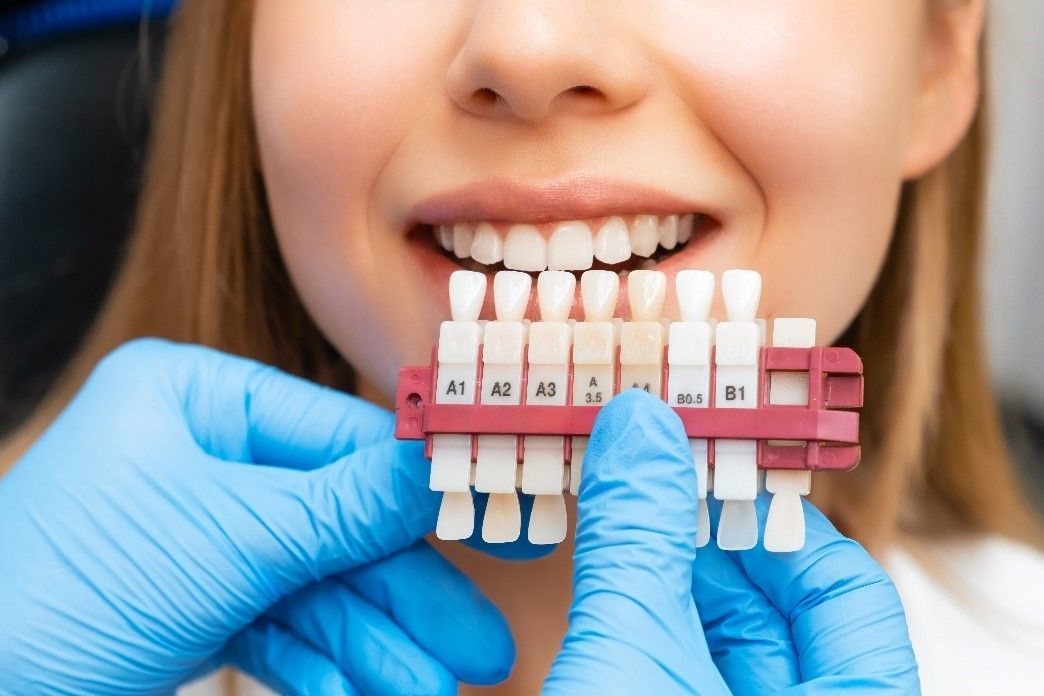cosmetic dental veneers