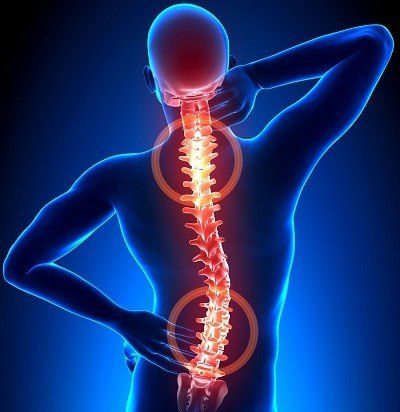 Physical Therapist's Guide to Scoliosis