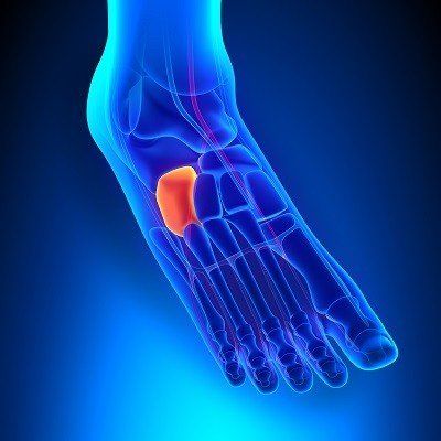 Make Sure You're Up To Date On The New Clinical Guidelines for Ankle Sprains  - Performance Health Academy