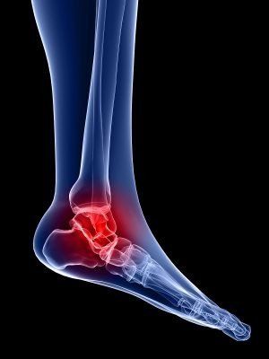 Why is ankle extension called plantar flexion?