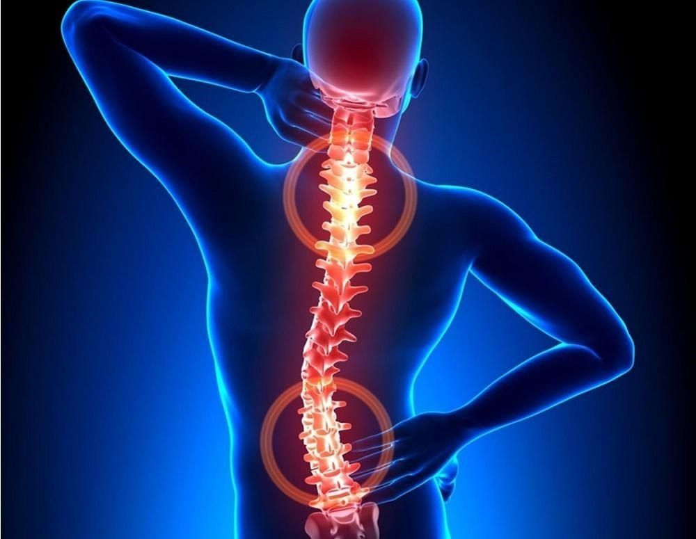 Herniated Disc: Causes, Symptoms, Treatment, and Prevention, ProActive  Physical Therapy Clinics