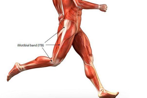 Physical Therapist's Guide to Iliotibial Band Syndrome (ITBS or It Band  Syndrome)
