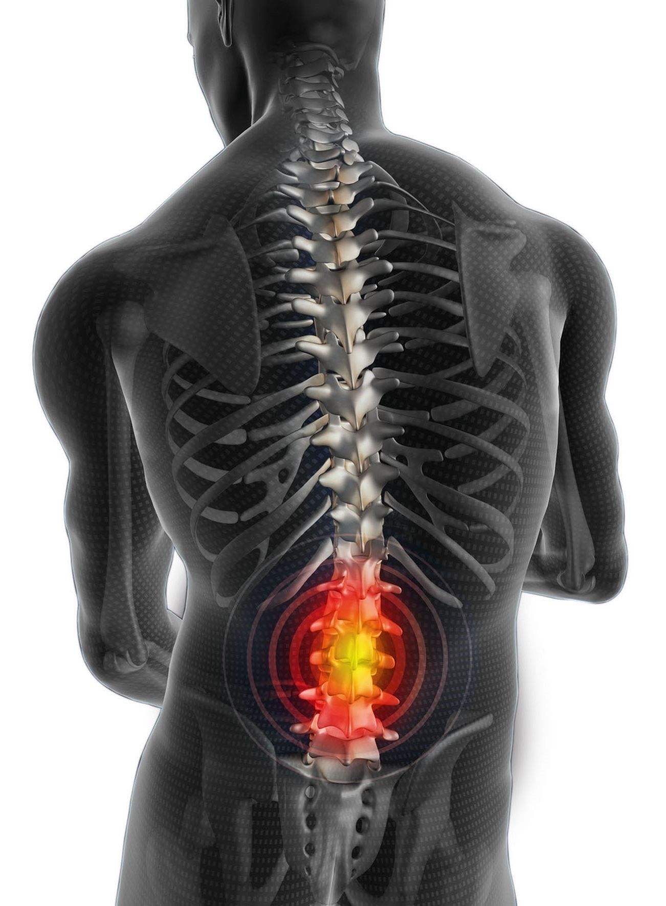 Physical Therapist's Guide to Low Back Pain