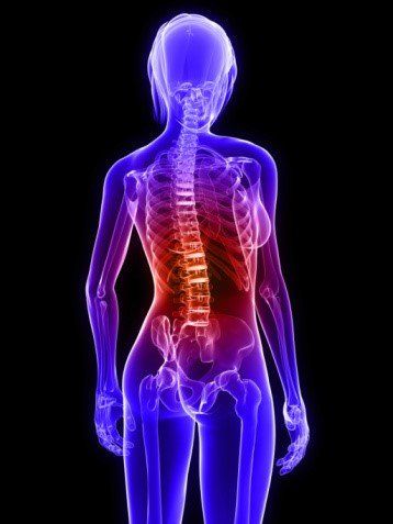 Proper Body Alignment - Bone Health & Osteoporosis Foundation