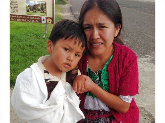 A MAYAN CHILD WITH A BROKEN ARM CAME TO VISIT OUR WAY-BI MISSION OF LOVE CLINIC.