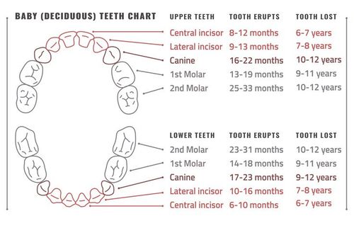 Dental Questions South-west Brisbane 