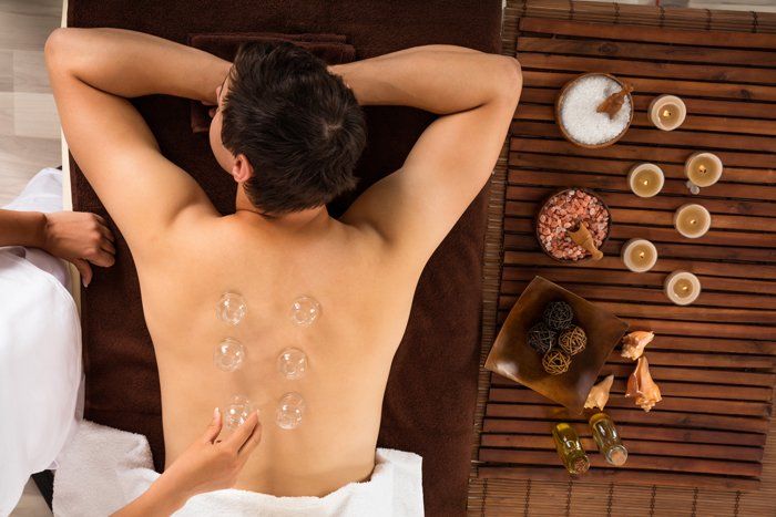 Swedish Massage — Man Receiving Cupping Treatment on the Back in Delray Beach, FL