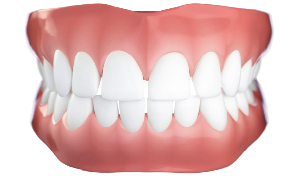 Diastema  tipo di malocclusione dentale - Studio dentistico AED Cesena