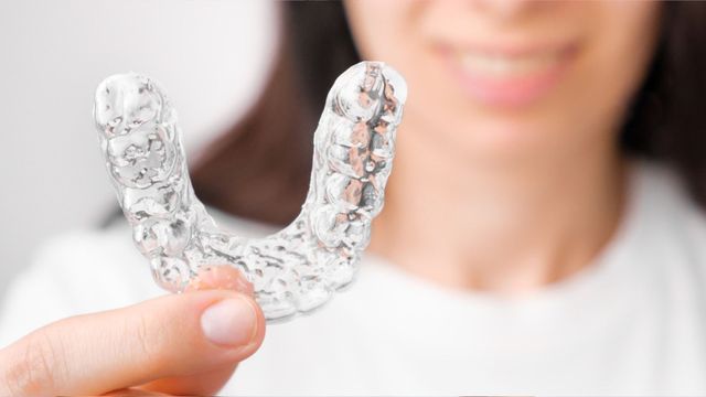 Come funziona Invisalign: l'apparecchio invisibile