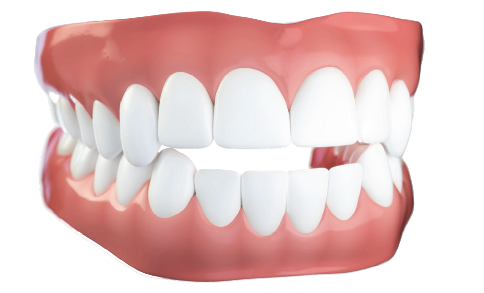 Morso aperto tipo di malocclusione dentale - Studio dentistico AED Cesena