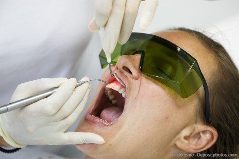 Behandlung von Parodontitis per Dental-Laser