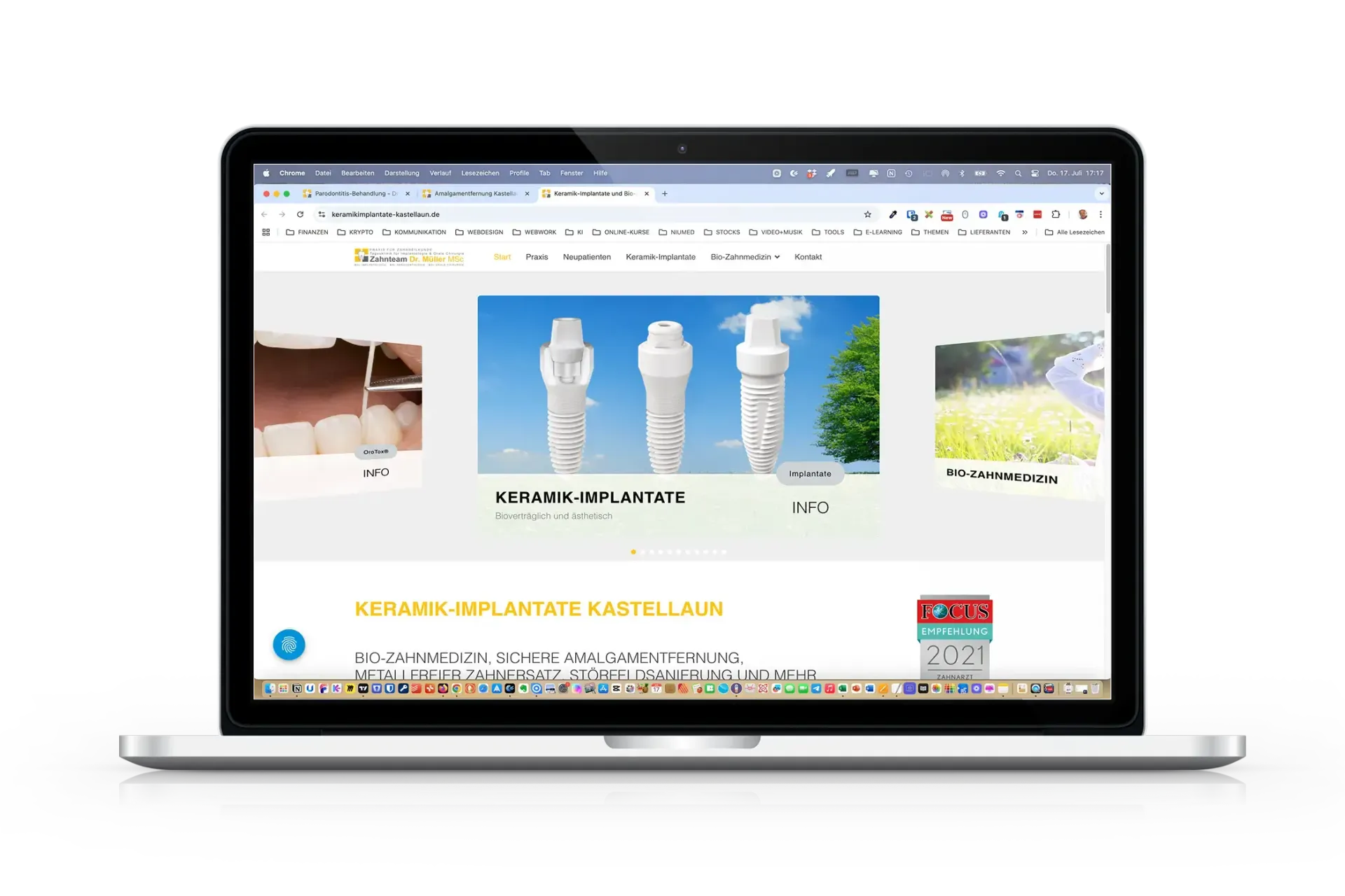 Keramik-IMplantate, metallfreie Zahnbehandlung und mehr