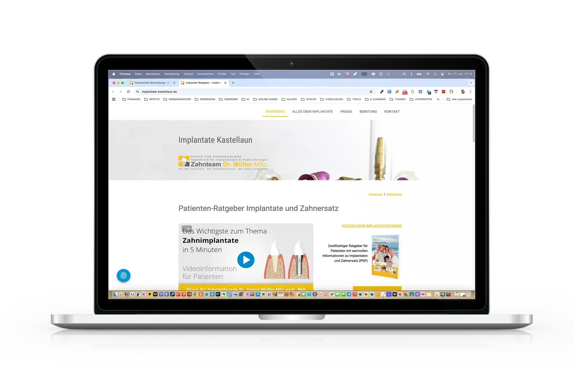 Moderne Implantologie