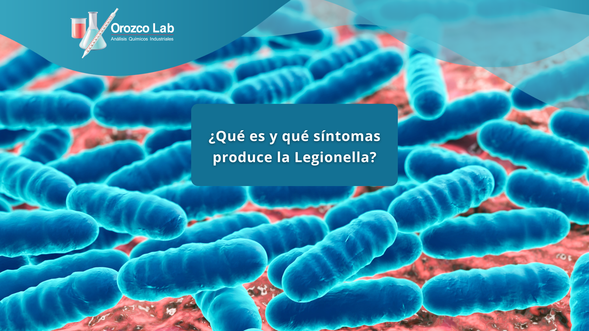 que-es-y-que-sintomas-produce-la-legionella