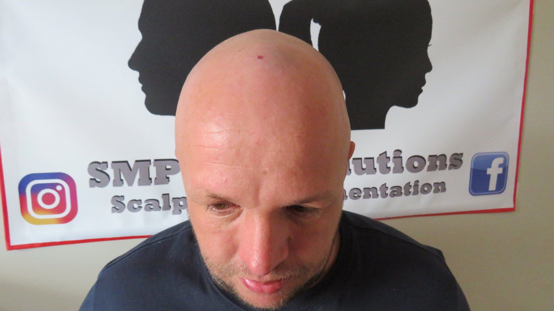 SMP Hair Solutions 28