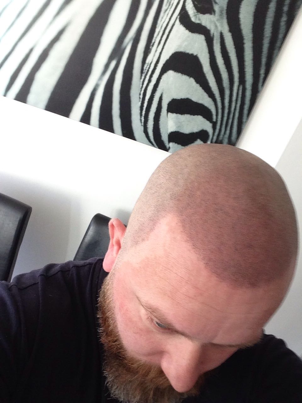 SMP Hair Solutions 24