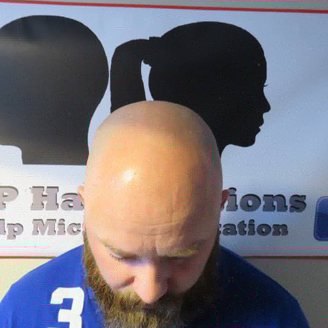 SMP Hair Solutions 16