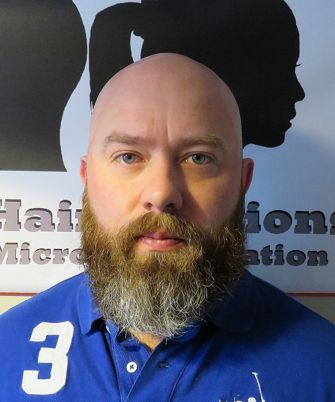 SMP Hair Solutions 15