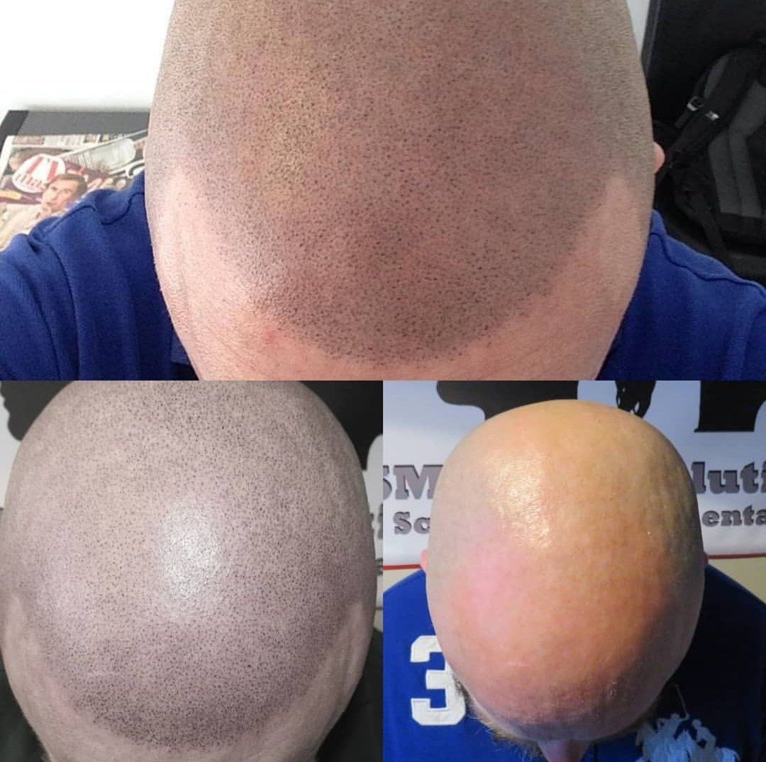 SMP Hair Solutions 61