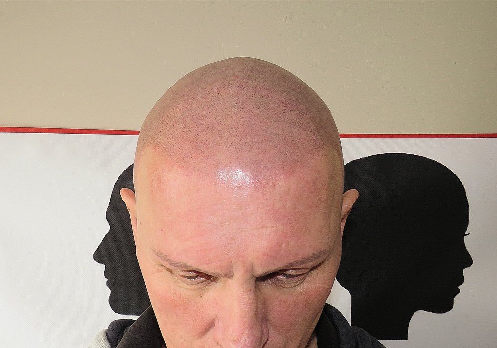 SMP Hair Solutions 43