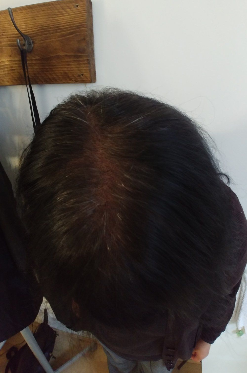 SMP Hair Solutions 59