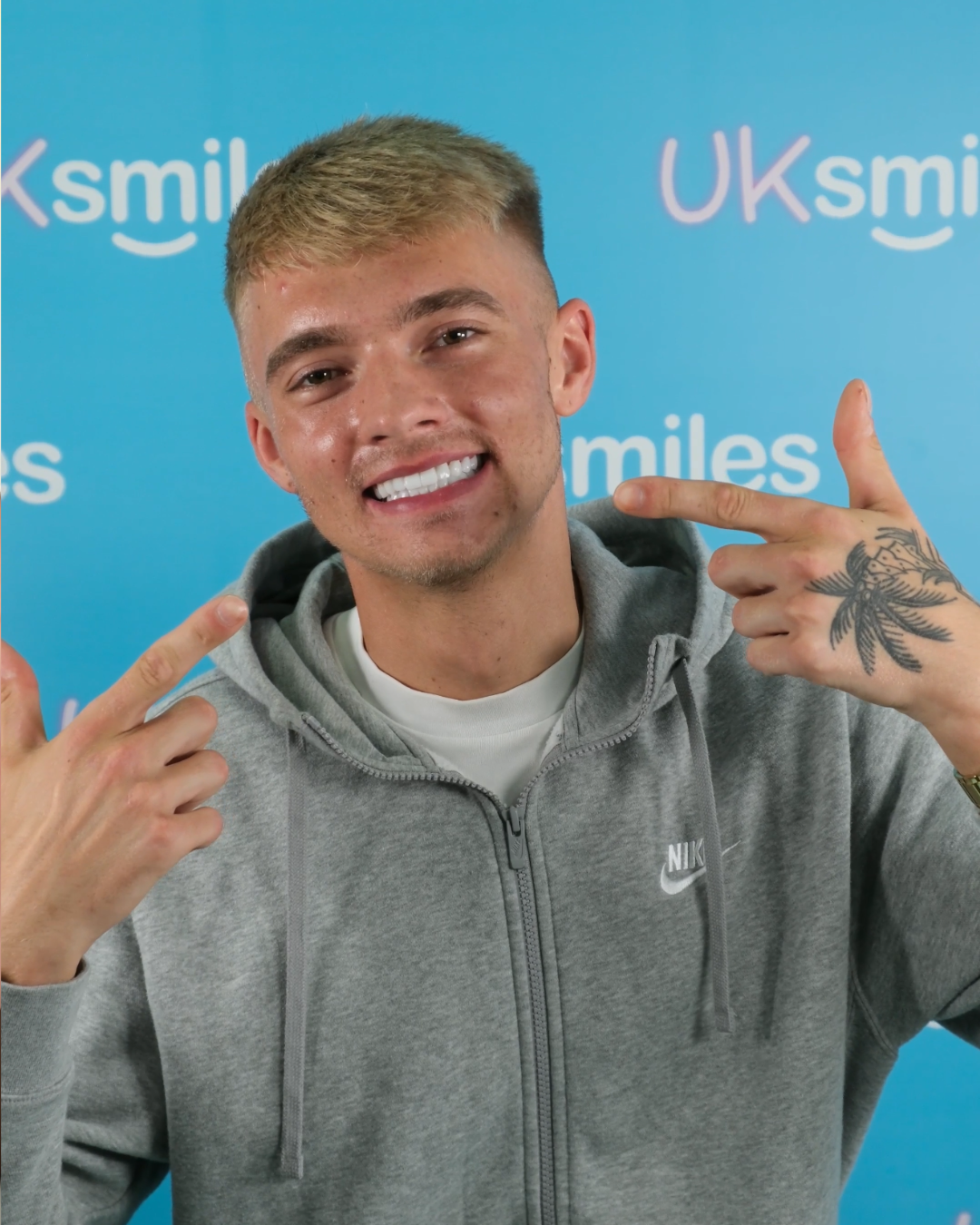 Man with freshly whitened teeth, smiling, pointing to them. Tattoo on hand, wearing gray hoodie.