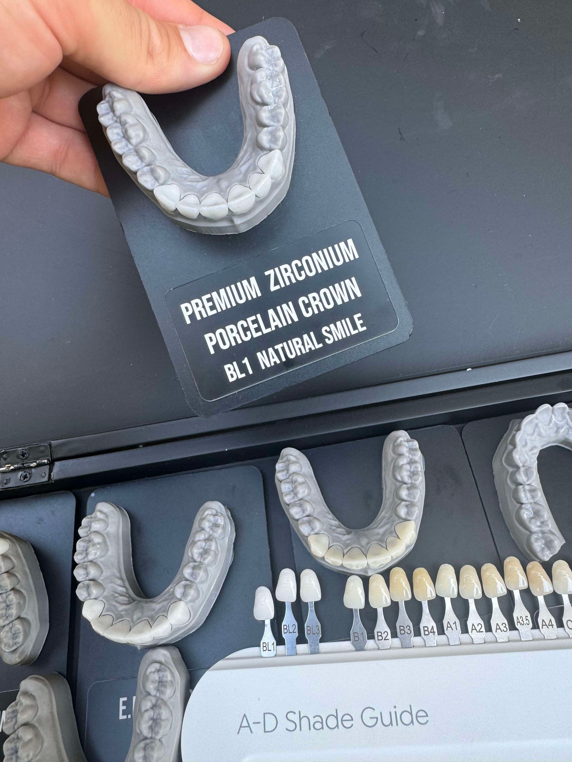 Hand holding a dental mold labeled