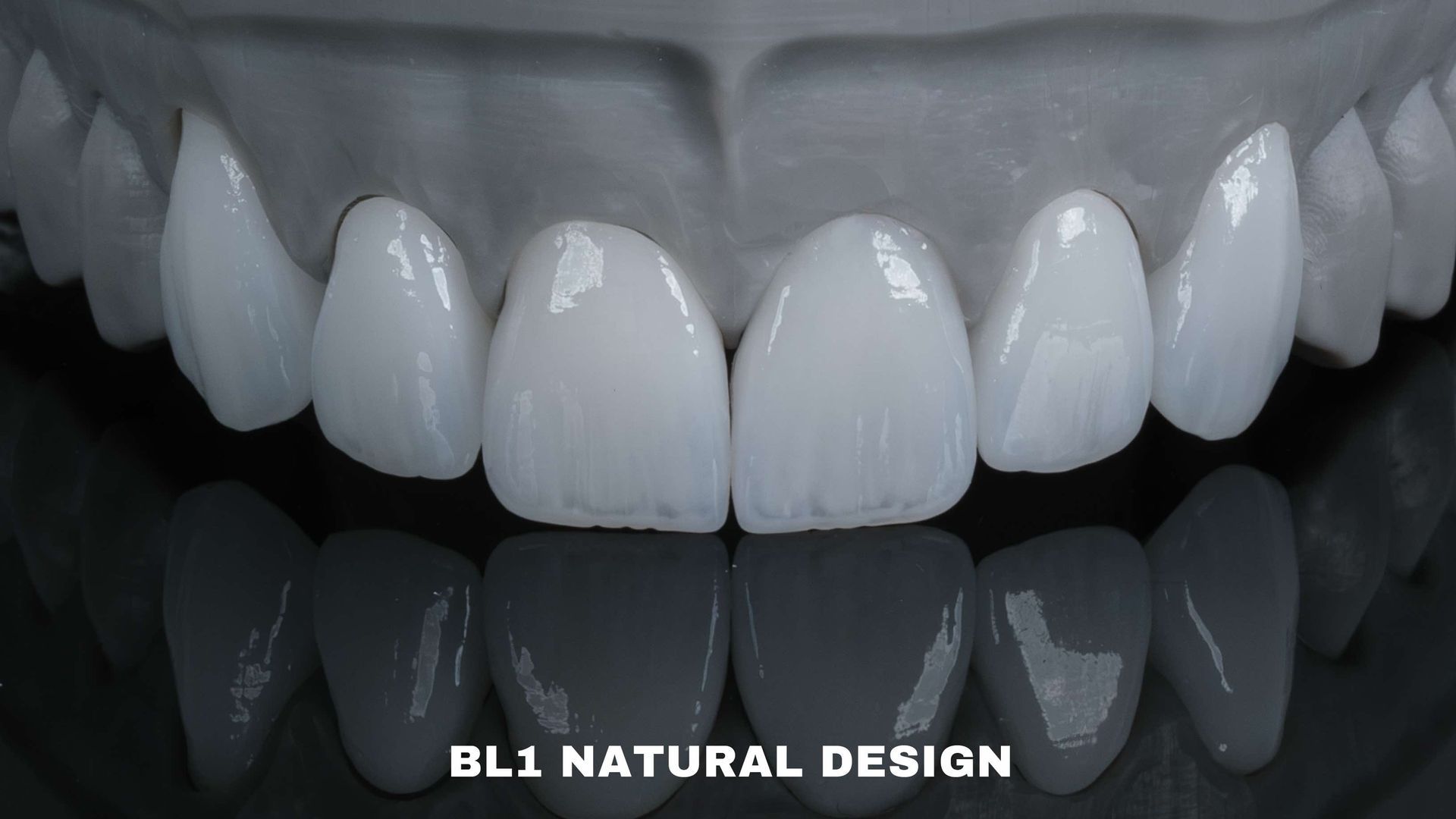 Close-up of dental veneers in a natural design, colored BL1, shown against a dark background.