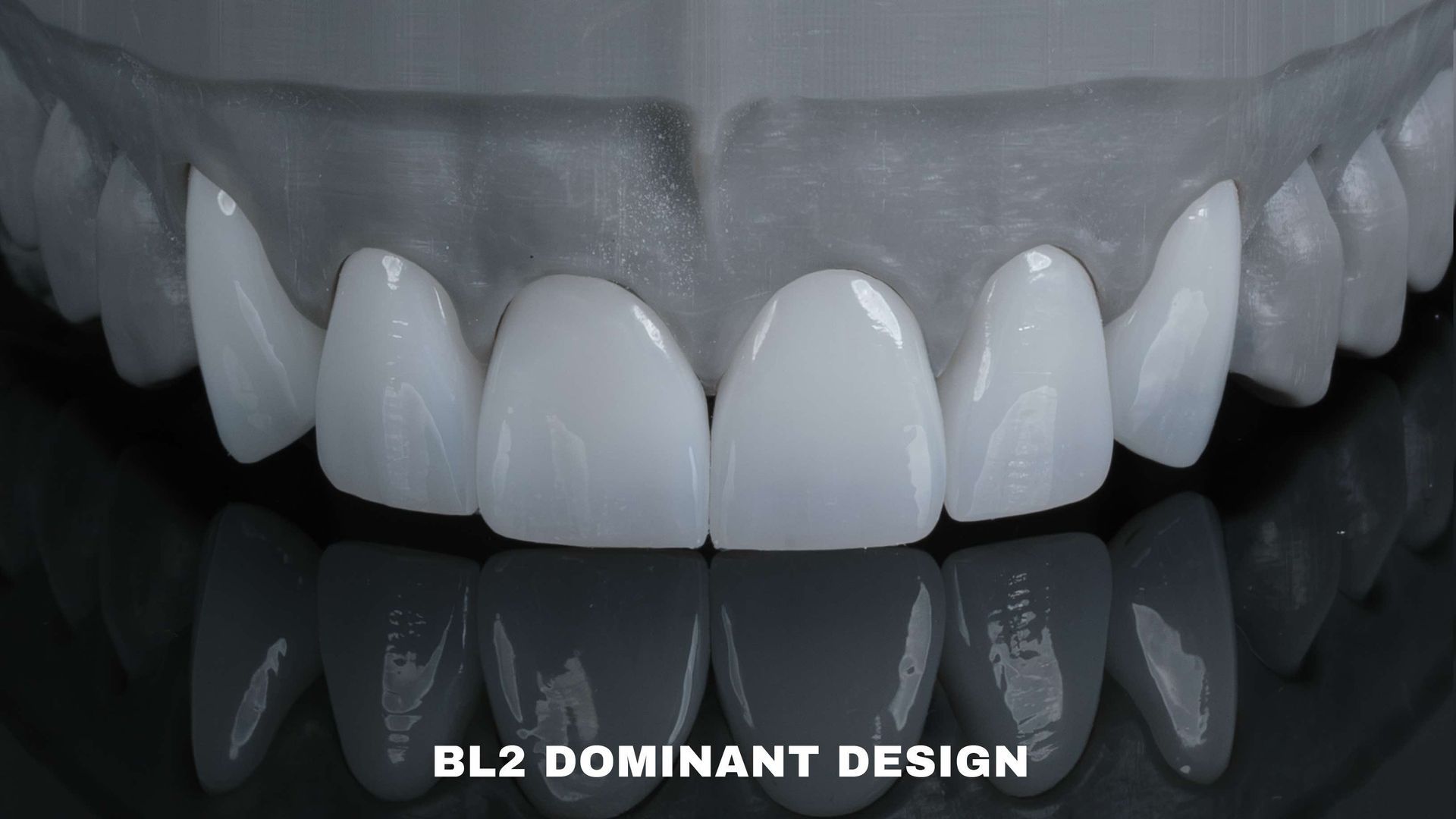 Close-up of a dental model showing bright white BL2 teeth with a 