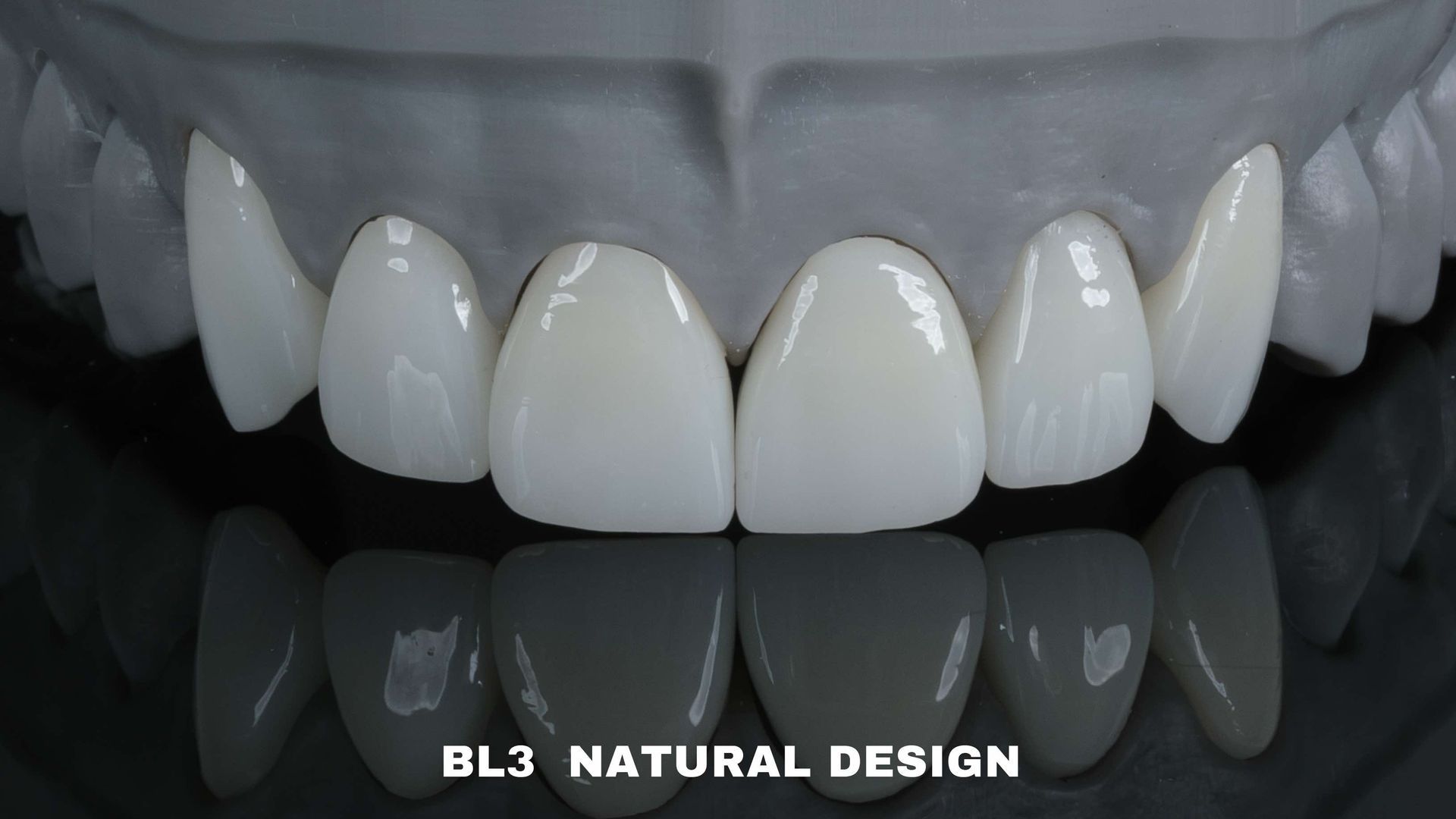 A dental model showcasing BL3 natural design veneers. White teeth with rounded edges are shown in a mouth setting.